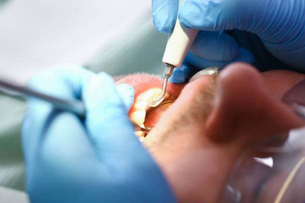 Best Emergency Tooth Extraction  in Fairborn, OH