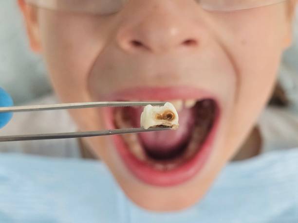 Best Emergency Pediatric Dentist  in Fairborn, OH