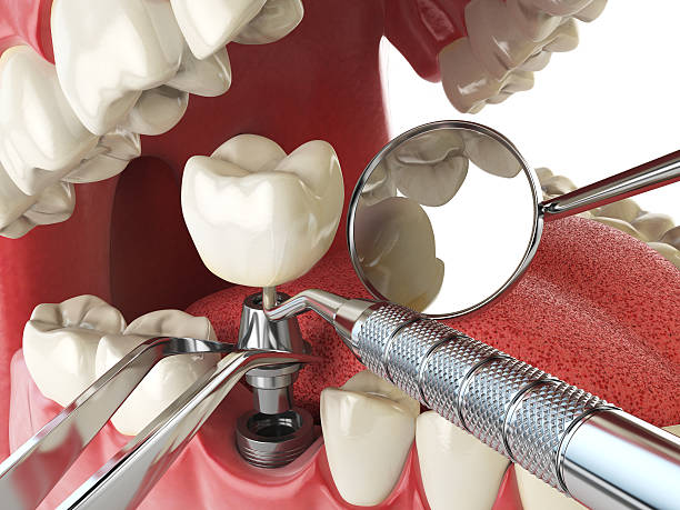 Best Emergency Gum Pain Relief  in Fairborn, OH